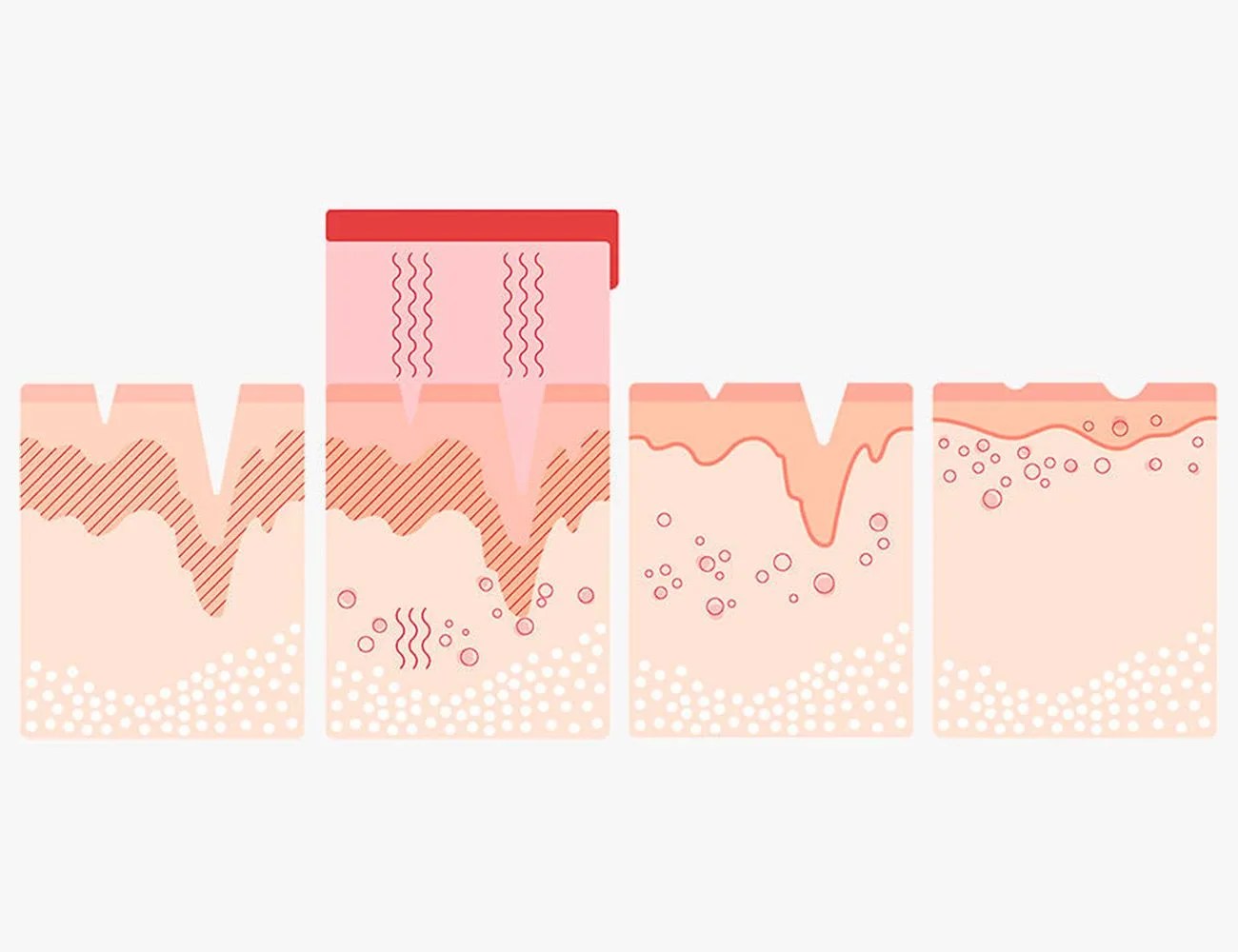 red light therapy on skin